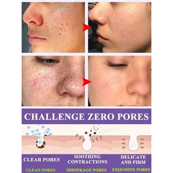 Porer fjerner pore krympende serum krympe oppstramming minimering
