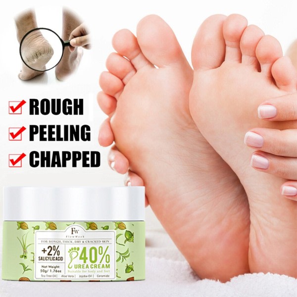 Fod Creme Hårdhud Fjerner Fod Fugtcreme Majs Hårdhud Død Skin Fjerner