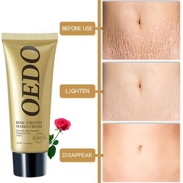 Rose fjerner stretch mærke creme for at fjerne reparation anti-aldring anti-blinker opstrammende body creme