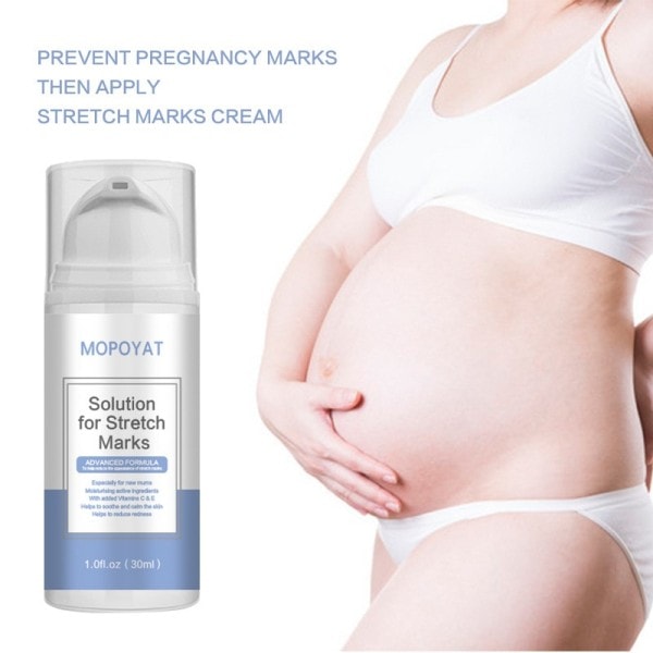 Stretch Mark Cream Repair Postpartum Är Avslappning Line Buken Stretch Mark Behandling Gamla och Nya Är Hudvård