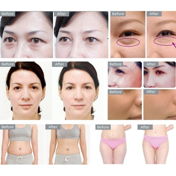 Krop Slankning 40K kavitation ultralyd vægt tab hud foryngelse skønhed  maskine 9d89 | Fyndiq