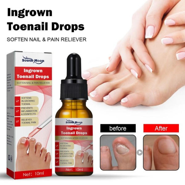 Tånagel behandling serum nagel korrigering återhämtning olja smärtstillande nagel mjukmedel trimma med lätt olja fötter