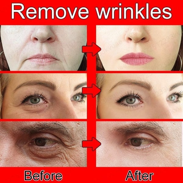Effektiv Anti-aging Anti-rynkor Ansikts serum för ansiktsbehandling rynkor fina linjer runt ögonen