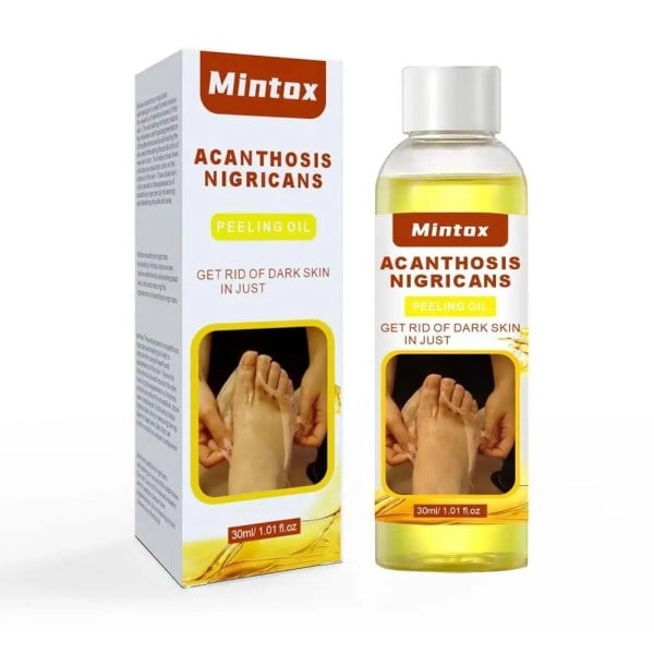 30ml Peeling Olie Albue Knæ Finger Sort Gul Olie Til Hud Lysning Fugtgivende Fjerner døde