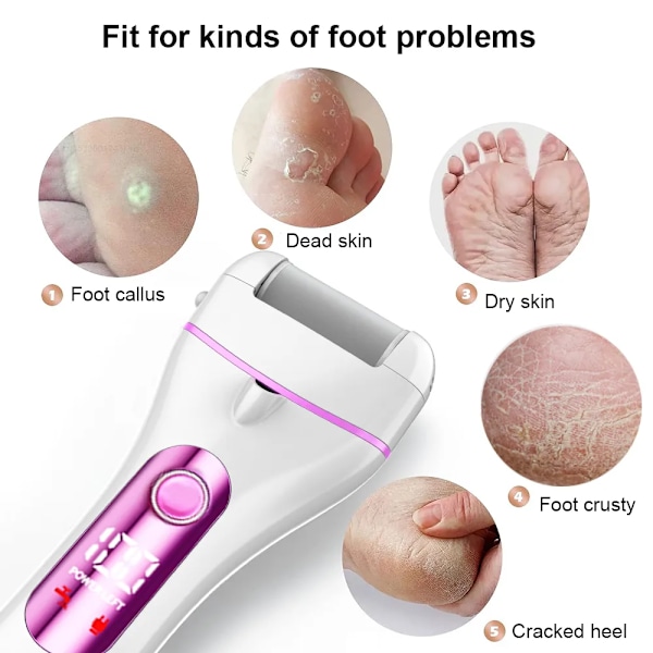 Elektrisk Fod Fil Callus Fjerner Kalk Til Fødder Og Hæle Elektrisk Fod Sandpapir Pedicure Fod Eksfoliator