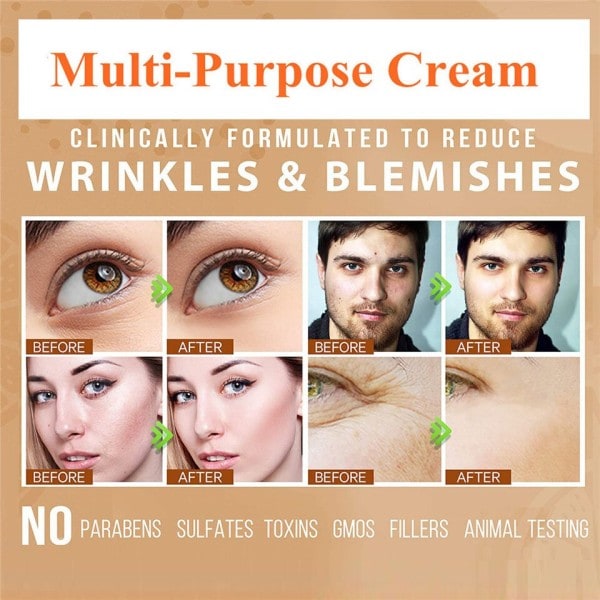 Retinol Anti rynkor Ansikte kräm Anti åldrande kräm Ta bort rynkor fuktande