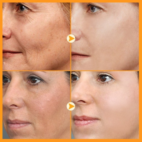 Retinol Ansikte kräm Anti-aging rynkor blekning Ljusare fuktgivande Ljusare fina linjer
