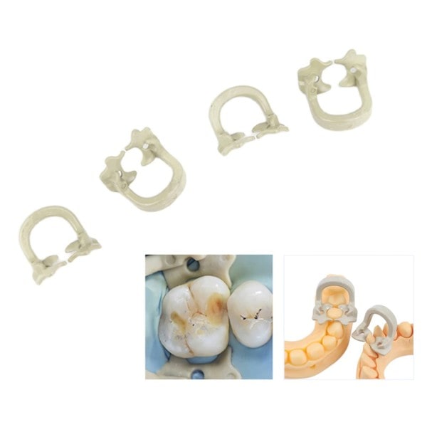 4st set Dental Dam klämmor Harts barriär klämmor gummi sektions matris band molar klämmor