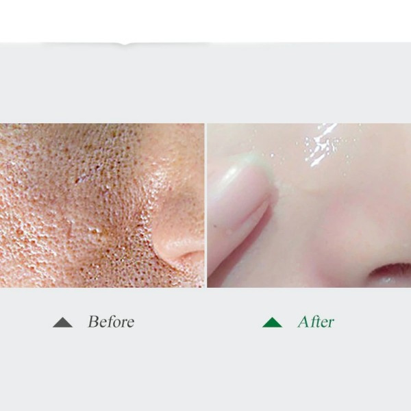 Porer Clean Blackhead Anti-aging Lighten Fine Lines Lång Laring Fuktgivande Whitening
