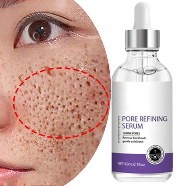 Hud Textur Por Refining Resurfacing Lightening Ansikts Serum med Retinol och Niacinamid