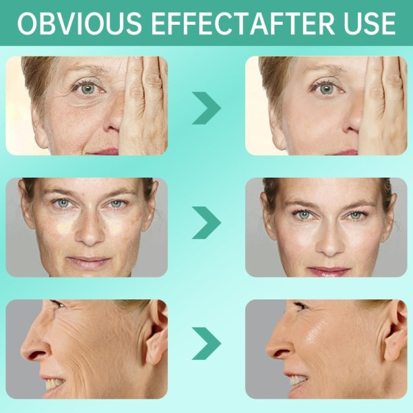 Lifting Opstrammende Creme Fjern Rynke Anti-Aging Fade Fine Linjer Ansigt Hvidning Lysere hud