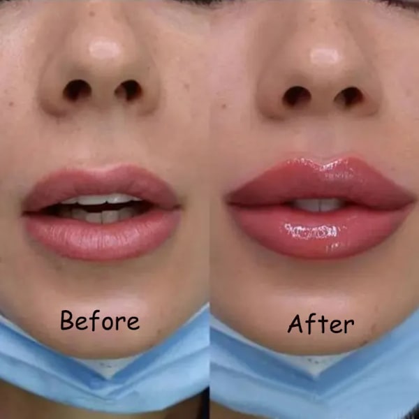 Læbe Plump Serum Forøg Læbe Elasticitet Øjeblikkelig Volumiserende Esentiel Olie Reducer Fine Linjer Reparation