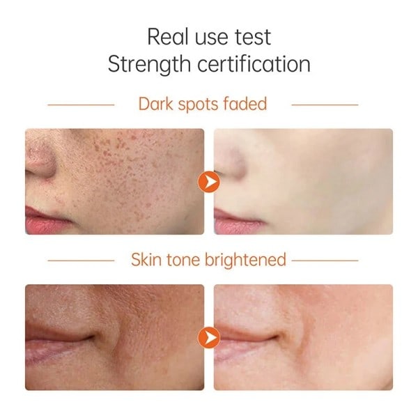 Vitamin C Serum Retinol Whitening Spot Control Oil Återfuktande Fade Mörk Fläck