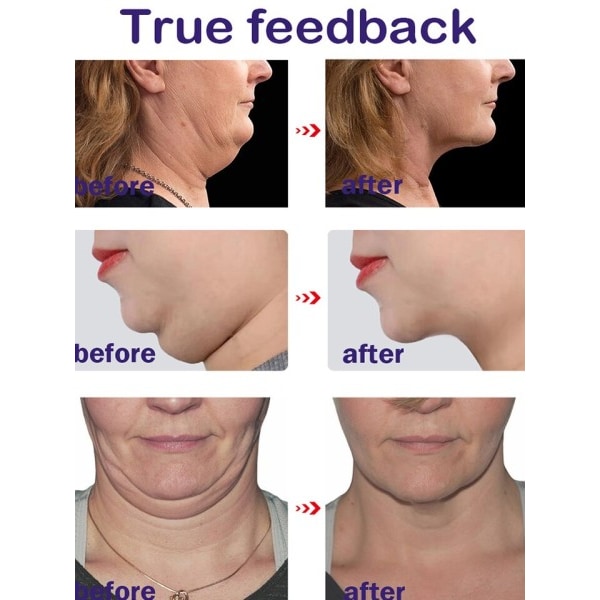 Face Cream Double chin elimination V Line Products