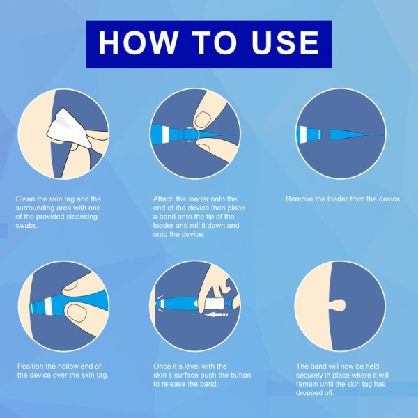 Hud Tag Remover Kit Mulvad Vårta Remover Utrustning Skin Tag Behandling Verktyg