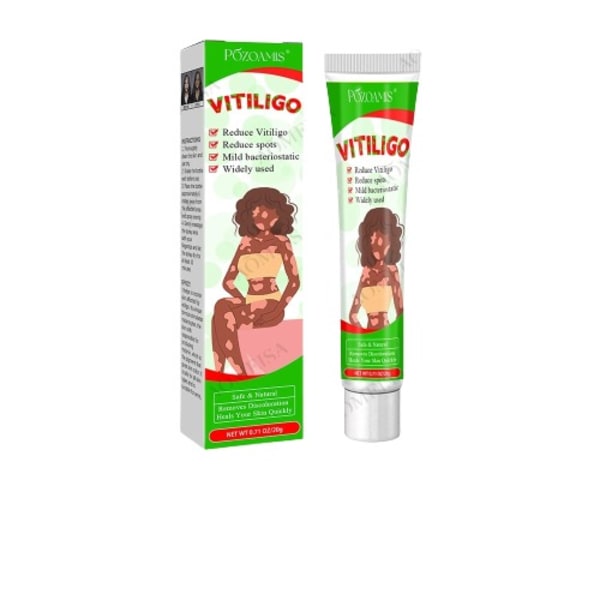 Urte ekstrakt vitiligo salve fjern ringorm hvite flekker fjerning