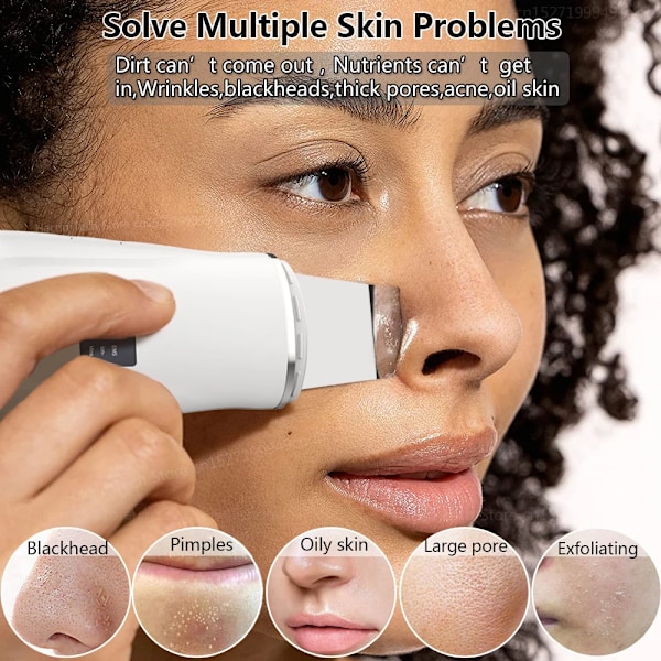 Ultraljud Peeling Remover Blackhead Ansikts Skin Scrubber Ansiktsbehandling Spad Djup rengöring Ansiktslyft Avlägsnande