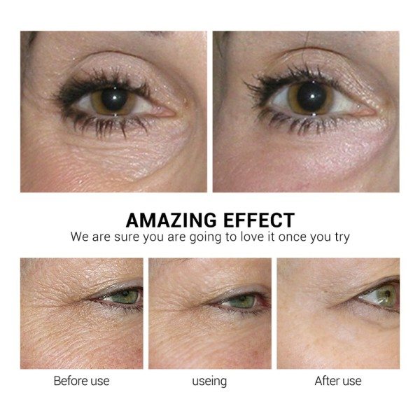 Øjen kollagen plastre Vc retinol øjne poser fjerner mørke cirkler anti-rynke aldring søvn øjen masker