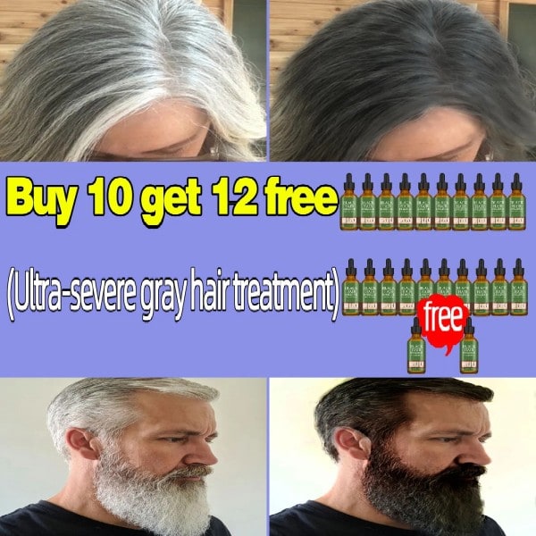 Anti grå hår essens hår sverting serum hvit hår behandling hvit til svart hår reparasjon pleie