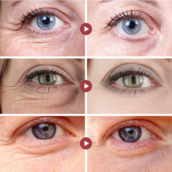 Anti-rynke øye krem retinol fjern øye poser mørke sirkler anti aldring hudpleie