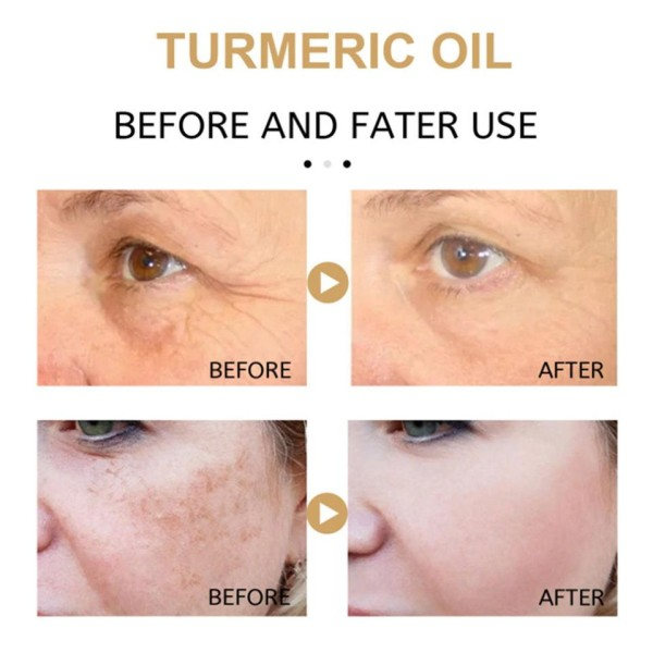 Gurkemeje Fregne Hvidning Olie Serum Curcumin Olie Brighten Farmed Mørke Pletter Fjernelse