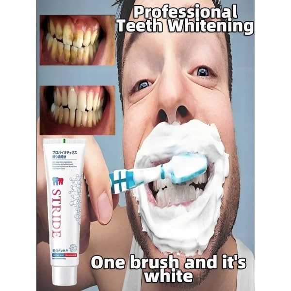 tand tandsten fjerner blegning tænder mund lugt fjernelse dårlig ånde Forebyggelse Periodontitis