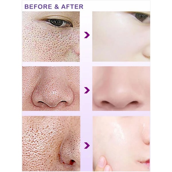Pore Shrinking Serum Shrink Porer Cream Lactobionic Acid Shrink Pores Serum