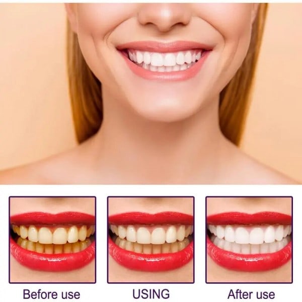 Tand Whiteing Set Clean Essence 3D Tooth Whitening Pen Tooth Gel Whitening Agent Bleaching Agent Plet Fjernelse Oral Hygiene
