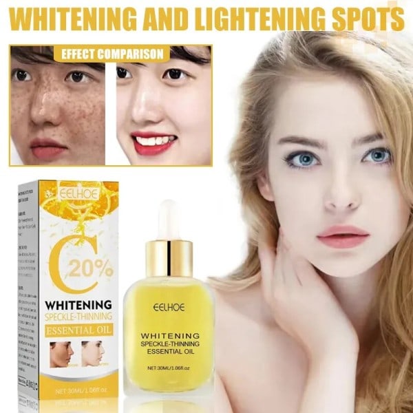 Mørke plet fjerner til ansigt sol melasma fregner pigment alder pletter fjernelse