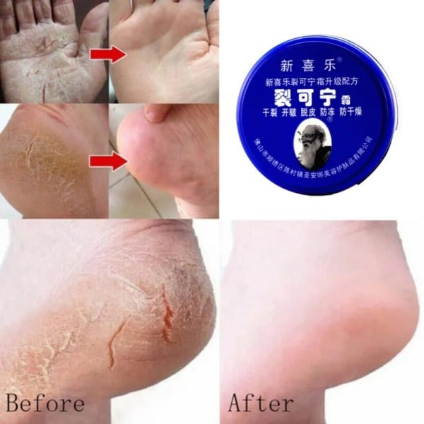85 g olie anti-tørrende revner fod creme hæl revnet reparation creme fjernelse død hud fugtgivende