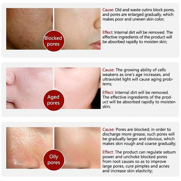 Hud Textur Por Refining Resurfacing Lightening Ansikts Serum med Retinol och Niacinamid
