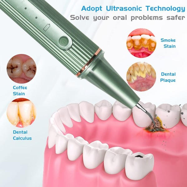Ultralyd Bærbar Elektrisk Tenner Dental Scaler Flekk Calculus Fjerner Verktøy Tann Cleaner Whitening Kit