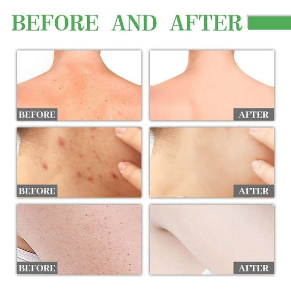 Ansigtsbehandling Essence Fugtgivende Serum Velegnet til sensitiv og tør hud 50ml