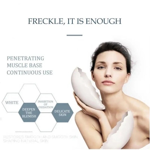 Whitening Freckle Cream Fuktgivande Ljusna upp Ansikte Ta bort Melasma Cream Ta bort Mörka Fläckar
