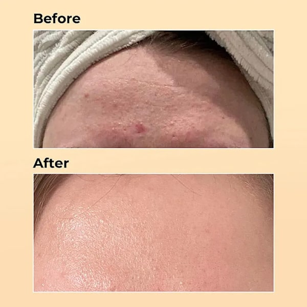 Power Repairing Essence Fugtcreme Creme Ansigtsbehandling Reparation Pleje
