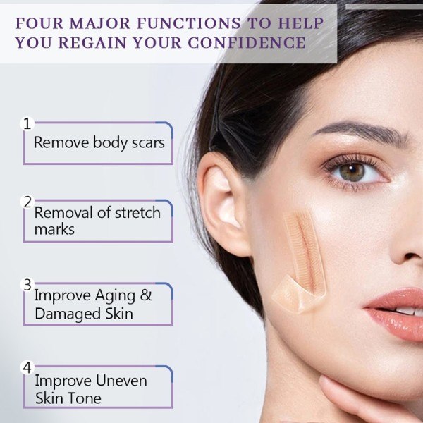Hud Behandling Olje Nærende Arr Fjerner Stretch Mark Fuktighetsgivende Serum  30ml*3PCS
