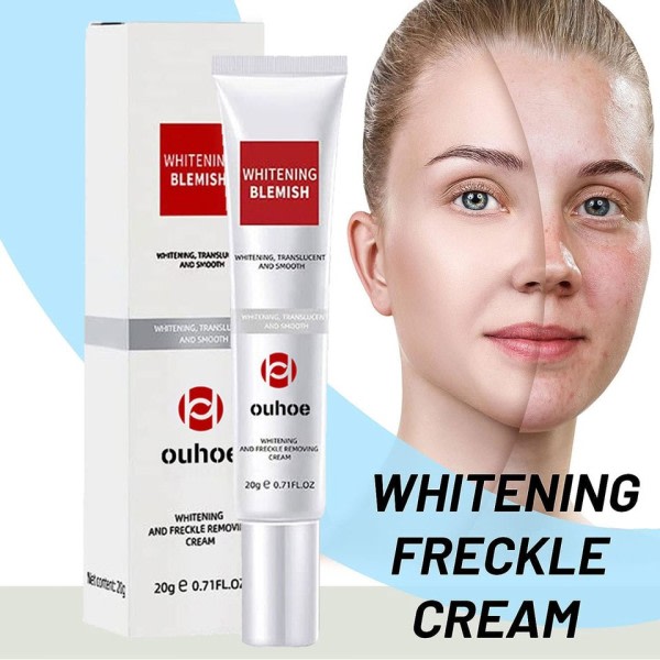 Mørk plet hud hvidning fade creme oplysning pletter fjernelse reducerer alder pletter fregner ansigt creme