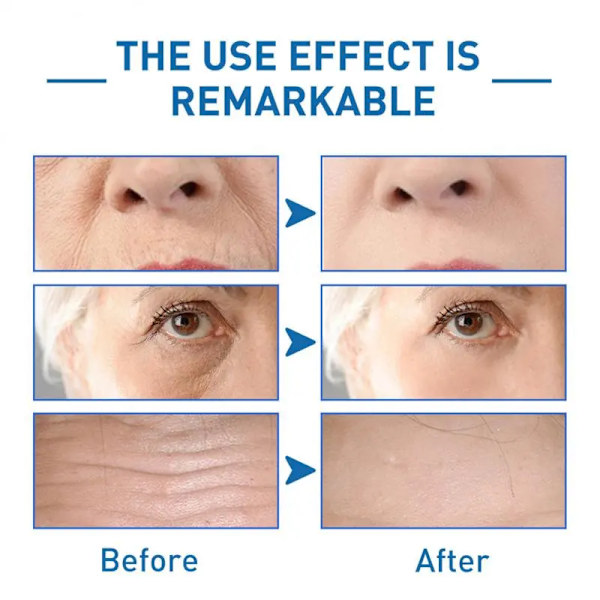 Ansikte Serum Oligopeptid Anti-rynk Stock Lösning Lifting Firming Skin Hydrating Antiaging Föryngrande Ansiktsbehandling Essence