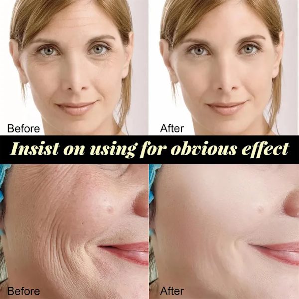 Lifting sæt ansigtsløftning og stramning kan absorbere anti-aging ansigtsbehandling essens collagen rynke fjernelse