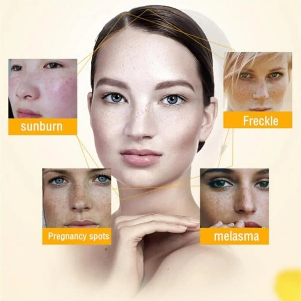 Whitening Freckle Cream Fuktgivande Ljusna upp Ansikte Ta bort Melasma Cream Ta bort Mörka Fläckar