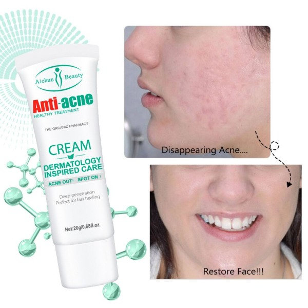Acne Behandling Creme Pore Shrink Olie Kontrol Hviding Reparation Bums Dyb rengøring Anti-acne Fugtighedscreme