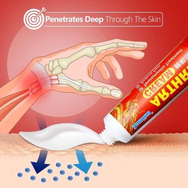 Creme varm reumatoid gigt led knæ smerte creme