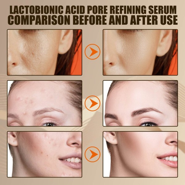 Effektiv porer fjerner pore krympe serum krympe oppstramming minimering