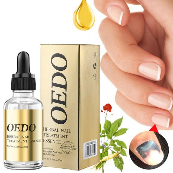 30ml sieni korjaus neste kynsien hoito eteerinen öljy  käsi ja jalkojen valkaisu varpaankynsi sienen poisto