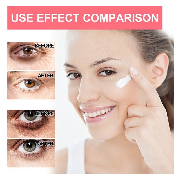 Anti-rynke øye krem retinol fjern øye poser mørke sirkler anti aldring hudpleie