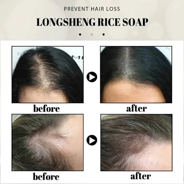 2 kpl riisi vesi shampoo saippua kiinteä hius kasvu shampoo patukka hius regrow shampoot