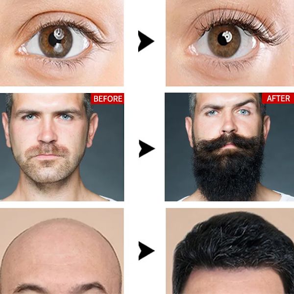 Øyenvippe Growth Serum Produkter Øyenvipper Øyenbryn Enhancer