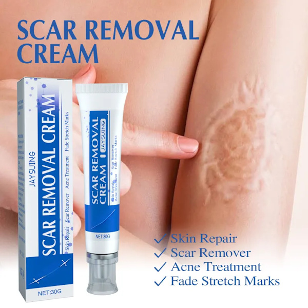 Urte ar fjernelse creme stretch mærker gel reparation pock mærke forbrænding kirurgisk ar fjerner