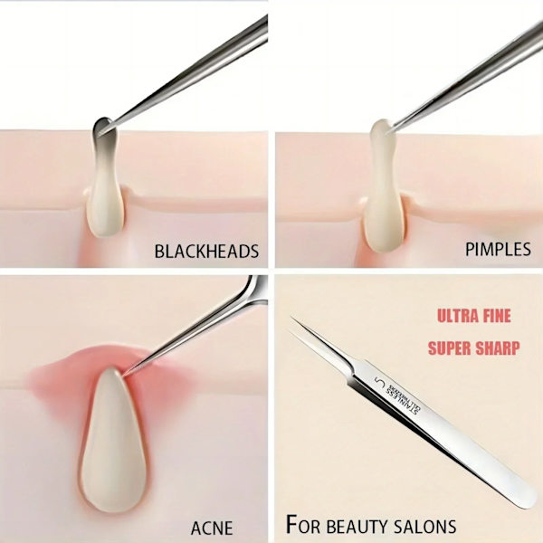 1 Pack Extra Fine No. 5 Cellular Acne Blackhead pincet