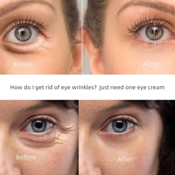 Anti-rynke øje creme falmer fine linjer anti mørke cirkler øjen serum fjern øje poser